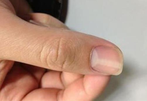 手指甲上月牙少說明什么，月牙和健康的聯系
