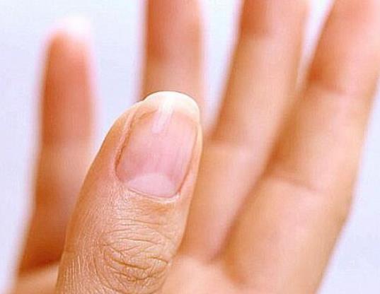 手指甲上的月牙什么意思，代表什么