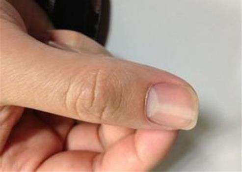 手指甲月牙少是身体不好吗，代表什么