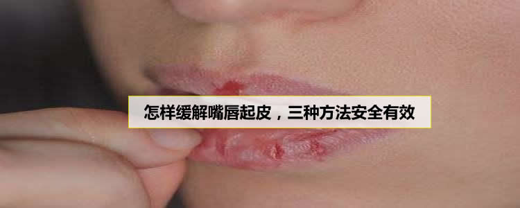 怎樣緩解嘴唇起皮，三種方法安全有效