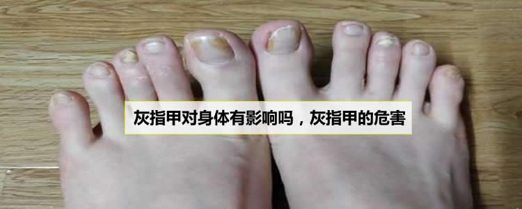 灰指甲對身體有影響嗎，灰指甲的危害