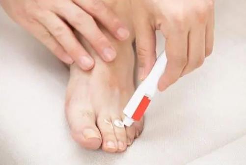 脚臭危害大吗，臭脚的日常护理