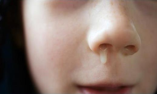 小儿鼻塞怎么办，有哪些常见症状