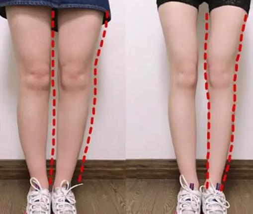 腿型的分类，不同腿型瘦腿方法