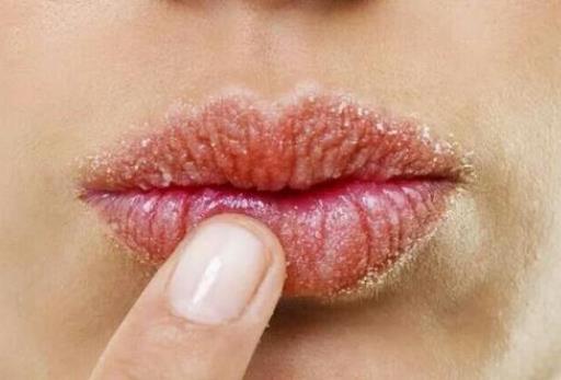 如何改善嘴唇发白，该怎么调理